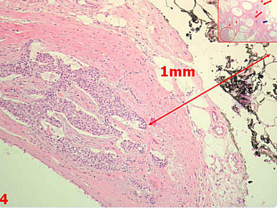 Pathodiag5