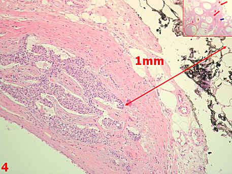 Histologische Abstandsbestimmung